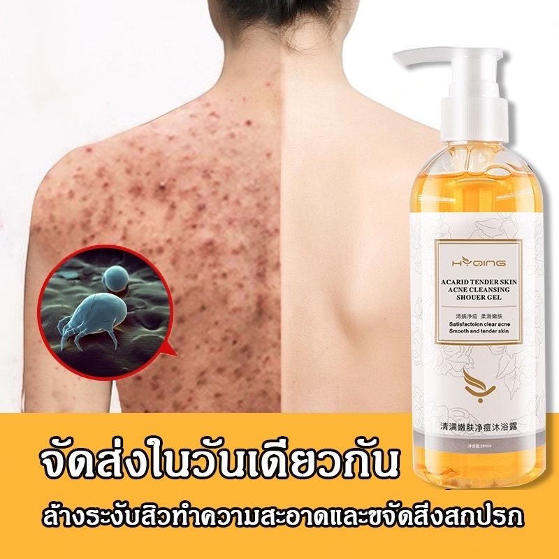 เจลอาบน้ํา ครีมอาบน้ำลดสิว เจลอาบน้ำไวท์เทนนิ่งผิว บำรุงซ่อมแซมผิว จัดการสิวแห้งผิวคันต่อต้านเชื้อราลดกลิ่นอย่างมีประสิท